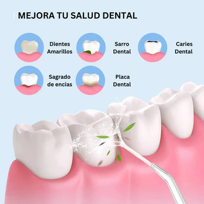 IRRIGADOR BUCAL👌 ADIOS AL MAL ALIENTO Y DIENTES AMARILLOS👌