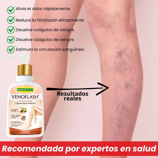 LA CREMA QUE ELIMINA EL PROBLEMA DE LAS VENAS VARICOSAS